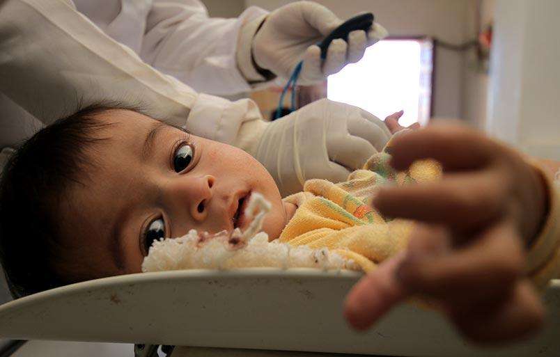Children fall sick due to malnutrition