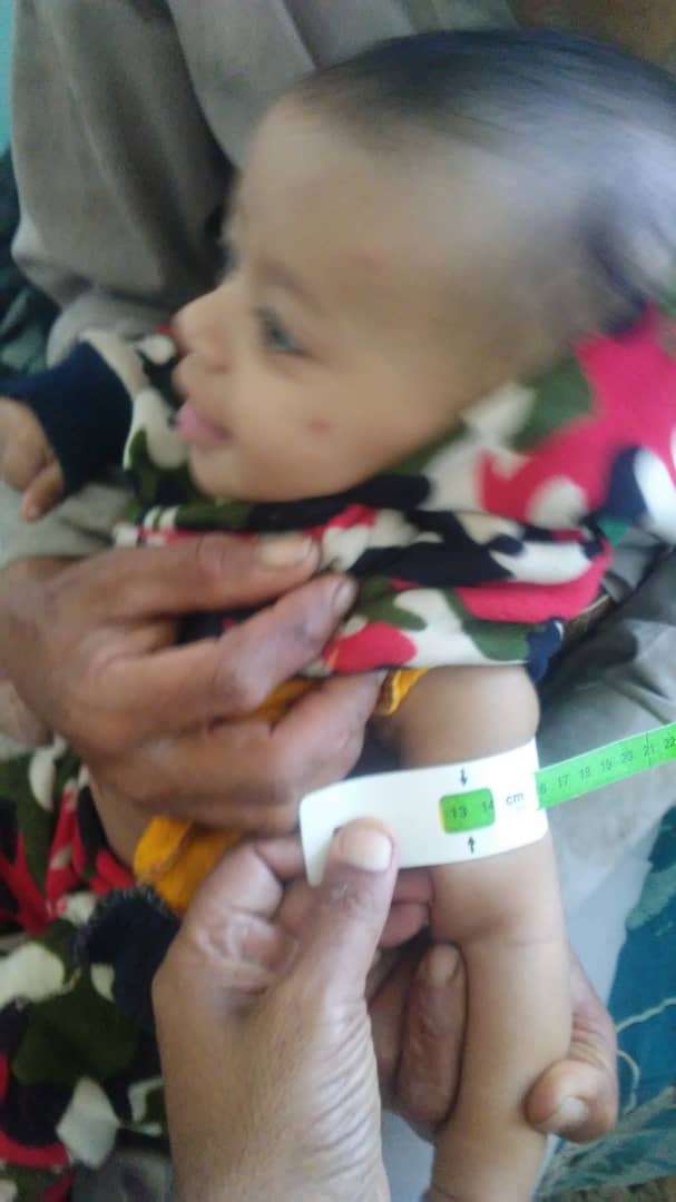 Zainab, while discharging from TSFP program 
Stayed for3 –months under treatment