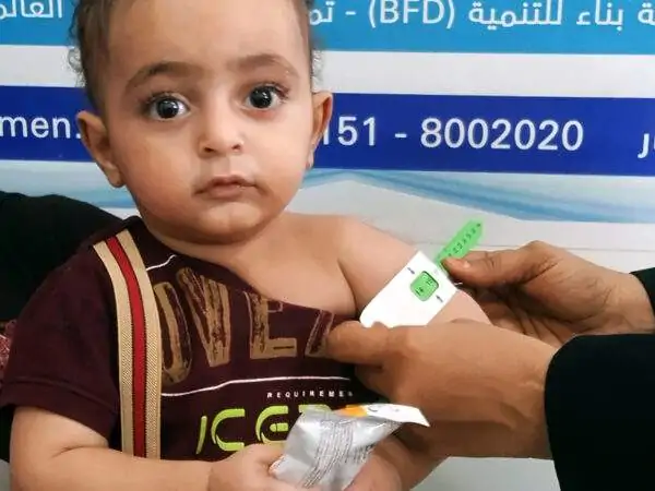 Nourishing Lives: Combating Malnutrition in Marib City-Yemen